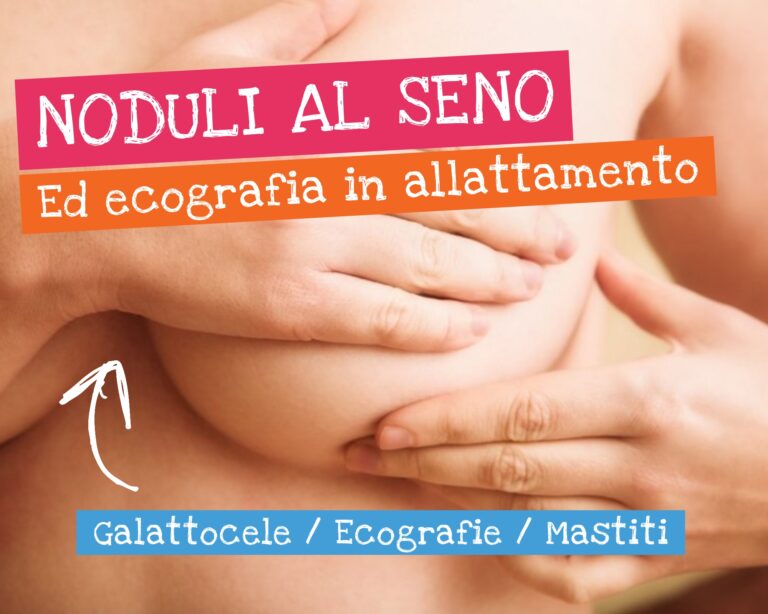 Nodulo al seno ecografia in allattamento